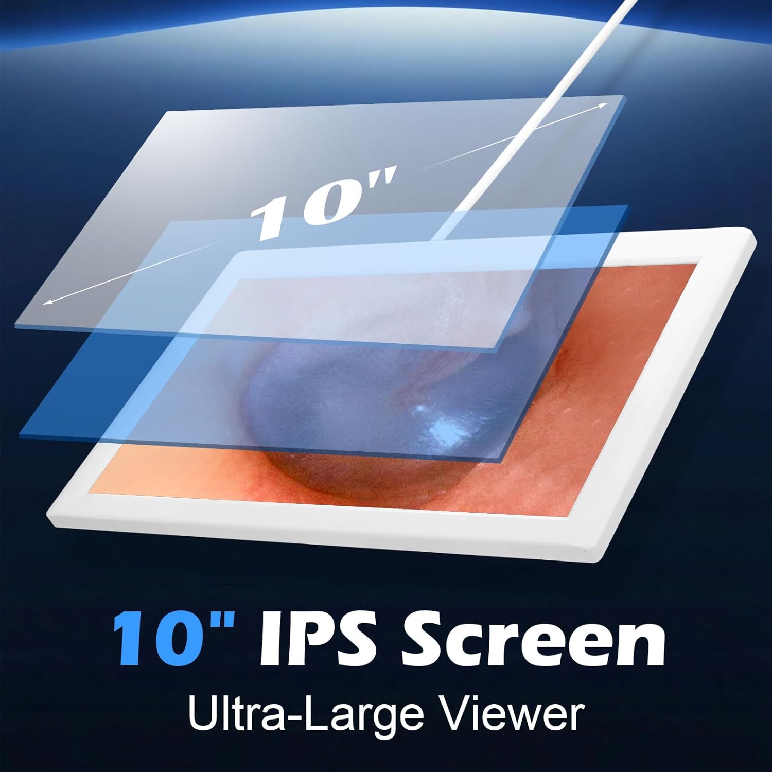 Otoscope Ear Camera，Ear Scope, with 10” Screen, 1080P HD Ear Camera, 6 LED LED Lights for Adult and Pet, Type-C Charging with Computer, Rechargeable Ear Wax Removal Tool Camera