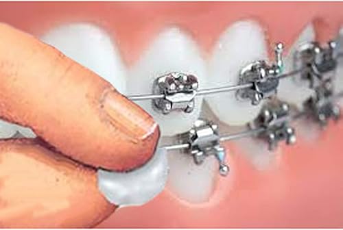 Miniatura 2 de Orthowax - Ceras dentales ortodónticas precortadas (paquete de 18) - Se pega mejor - Cera de ortodoncia de Orthomechanics - Aloe Vera y vitamina E