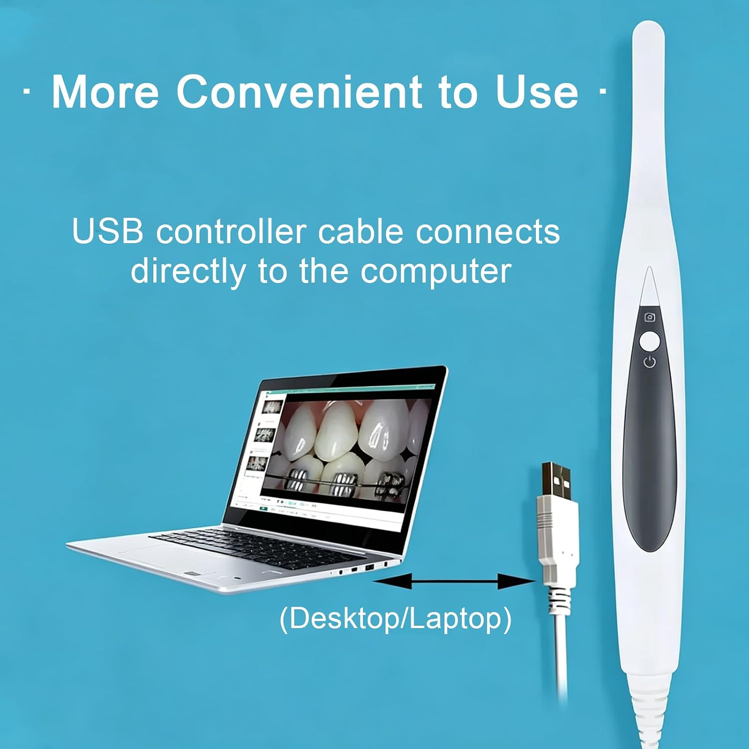 13MP Intraoral Camera 4.8mm Ultra-Thin Lens Dental Camera | USB 2.0 Connection, 8 Led, Dual Capture Buttons Works with Eaglesoft, Dexis, Apeteryx, Carestream, Tigerview and More