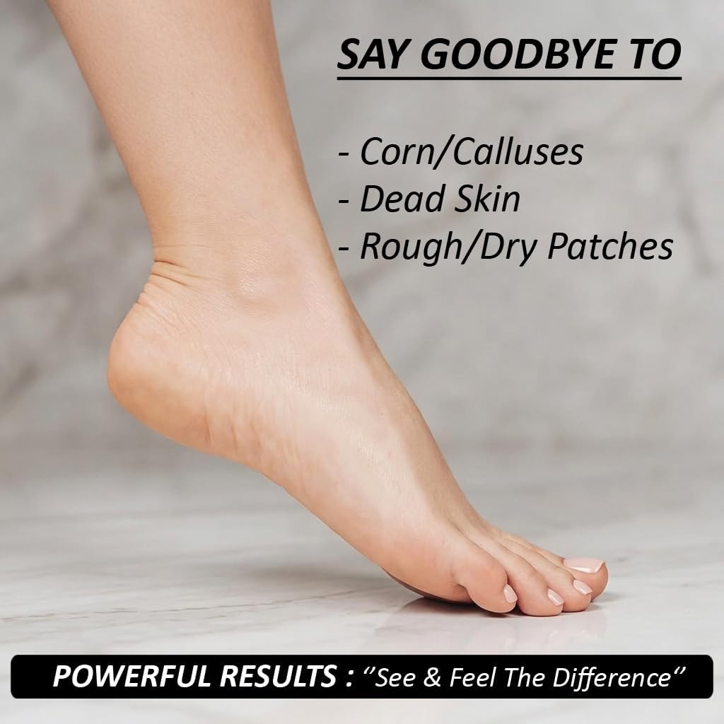 BEAUTICONE Professional Callus Shaver for Feet – Foot Scraper Pedicure Razor with Replaceable Blades – Hard Skin Remover for Cracked Heels & Dead Skin – Pedicure Foot Care Tool for Home & Salon Use