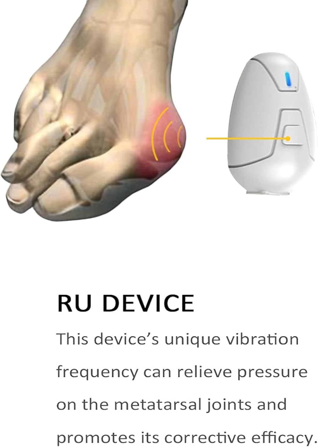 Hallux Valgus Toe Corrector, Bunion Splint Big Toe Straightener, Three Intensities Can Be Adjusted, Restore Toes to Their Original Shape, for Day/Night Support Hallux Valgus Pain Relief