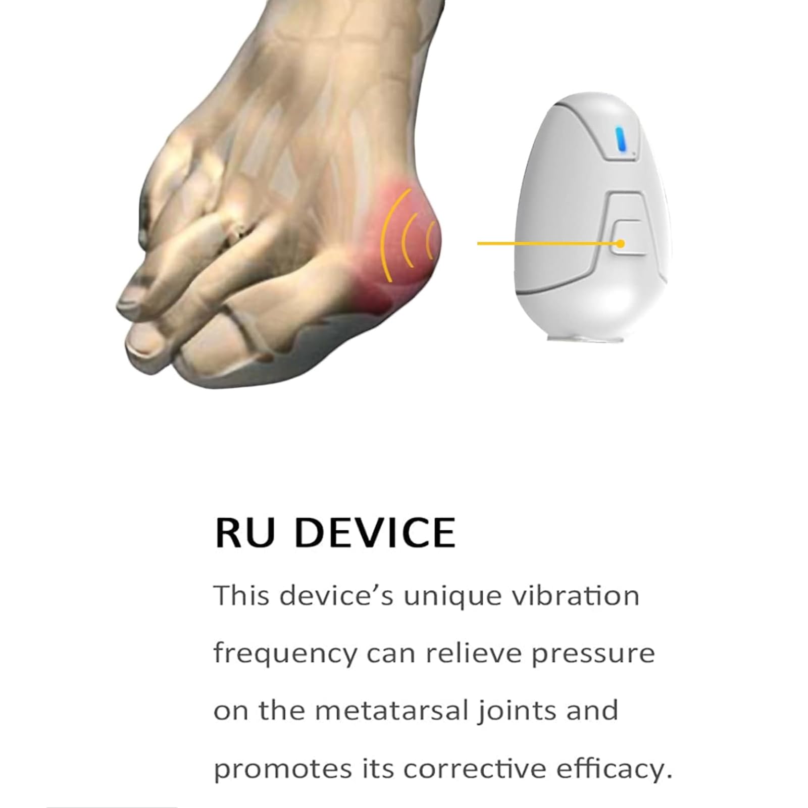 NGARY Corrector De Dedos Hallux Valgus, Férula para Juanetes, Alisador del Dedo Gordo del Pie, Se Pueden Ajustar Tres Intensidades, para Aliviar El Dolor De Hallux Valgus