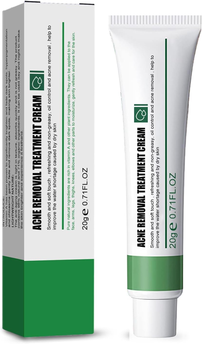 Anti Acne Cream for Acne Treatment and Spot Treatment with Nicotinamide, Sodium Hyaluronate, Aloe, for Acne Prone & Sensitive Skin, Reduce Redness, Moisturiser, Fade Acne Marks, Oil Control