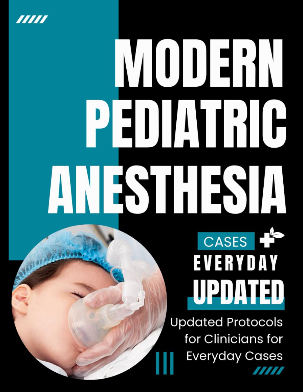 Modern Pediatric Anesthesia: Updated Protocols for Clinicians for Everyday Cases