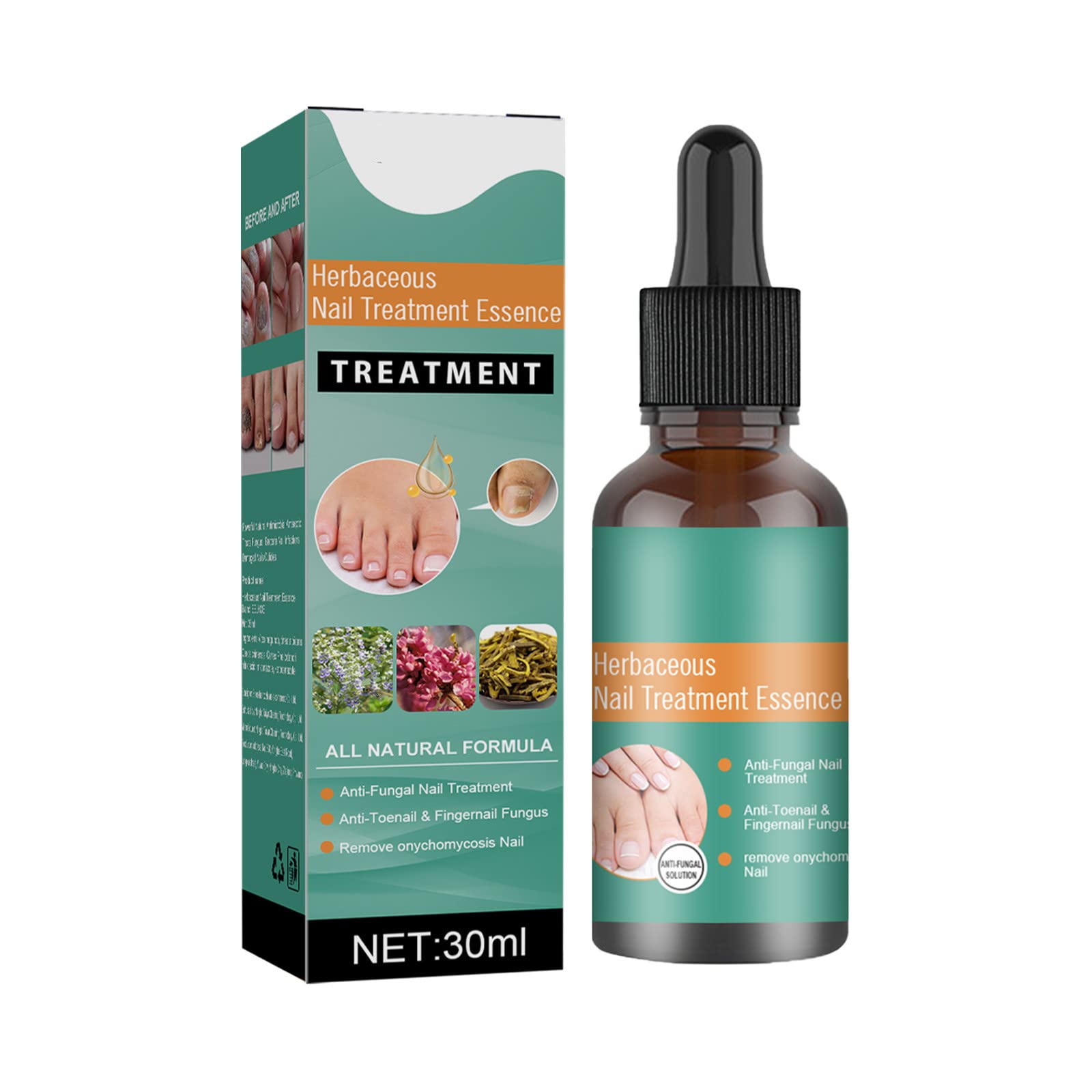 Buy Fungal Nail , Nail Helper Ingrowth Toenail Correction Oil Ingrown