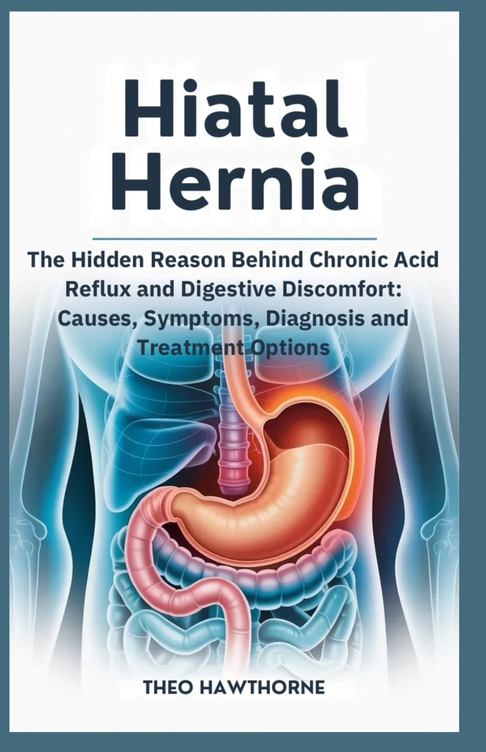 Hiatal Hernia: The Hidden Reason Behind Chronic Acid Reflux and Digestive Discomfort: Causes, Symptoms, Diagnosis, and Treatment Options