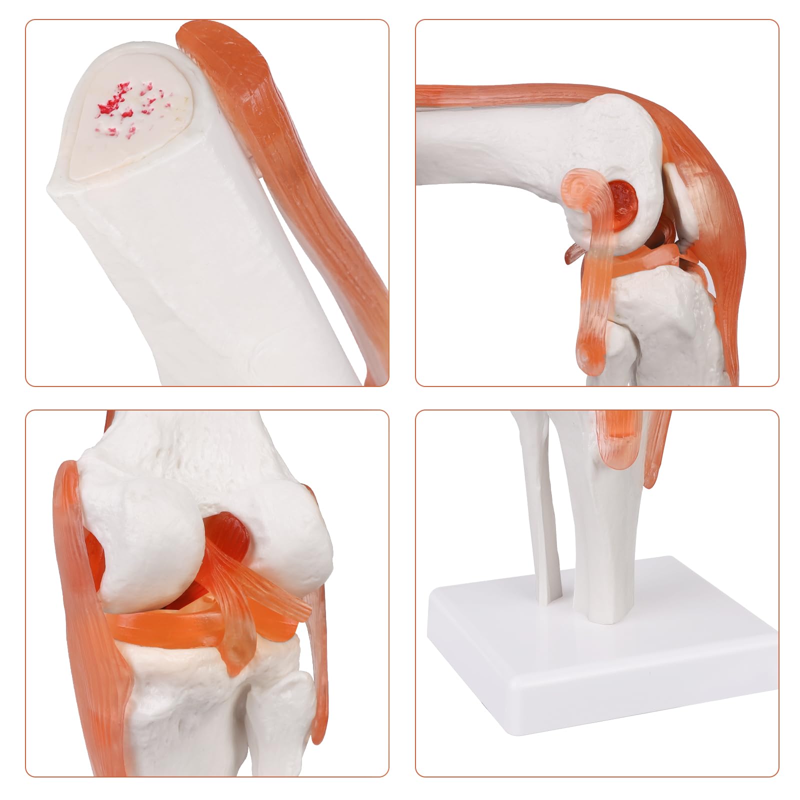 Model Van Een Gezond Kniegewricht. Beenmergligamenten En Meniscus 3d Illustratie Stock
