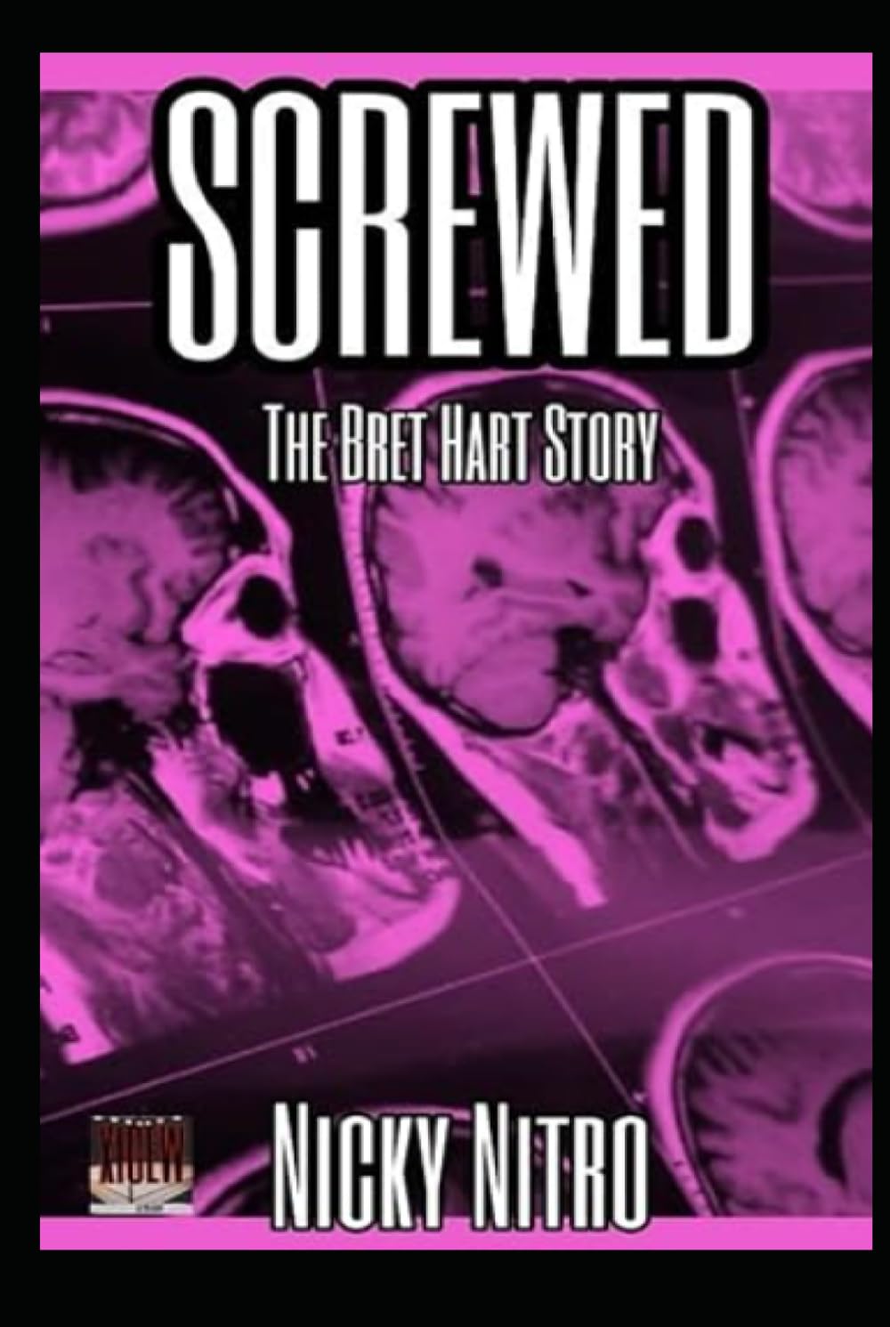Screwed: The Bret Hart Story