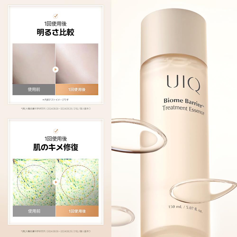 Amazon.co.jp: UIQ