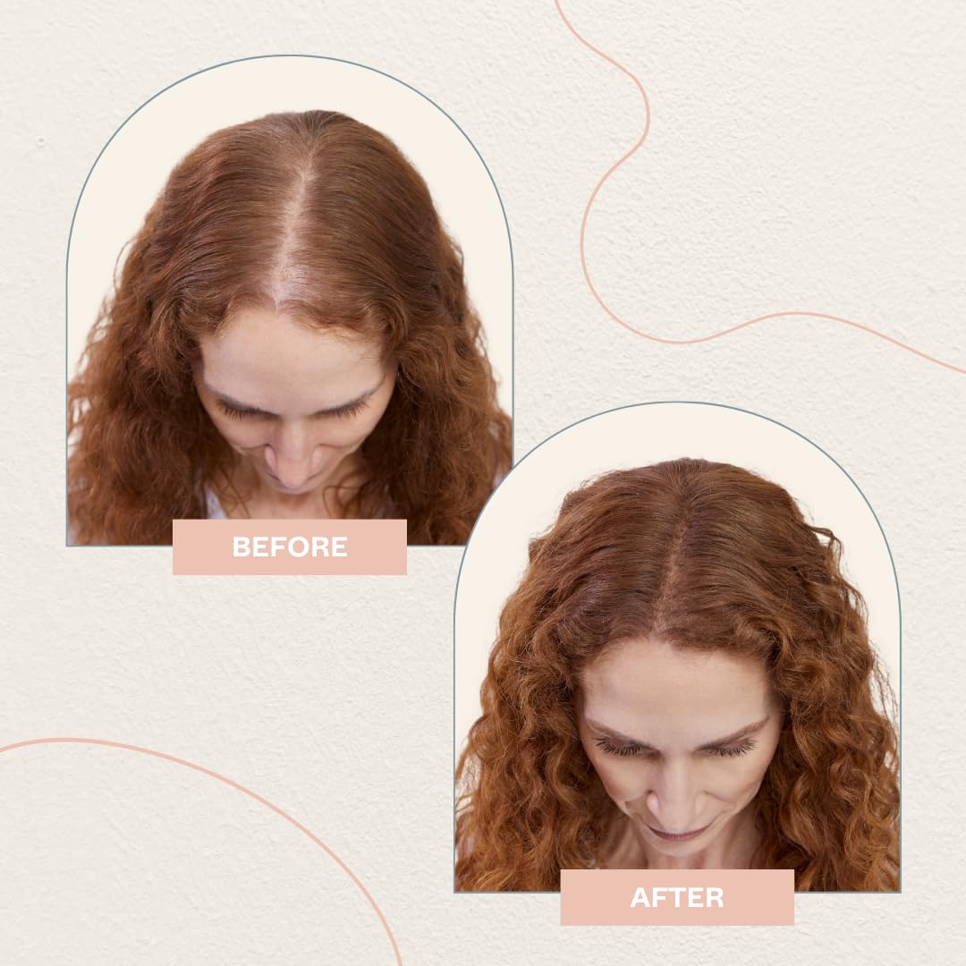 Generic ME Cosmetics AWARD WINNING CAN'T STOP ME NOW Scalp Foundation (Auburn) | Water Proof |