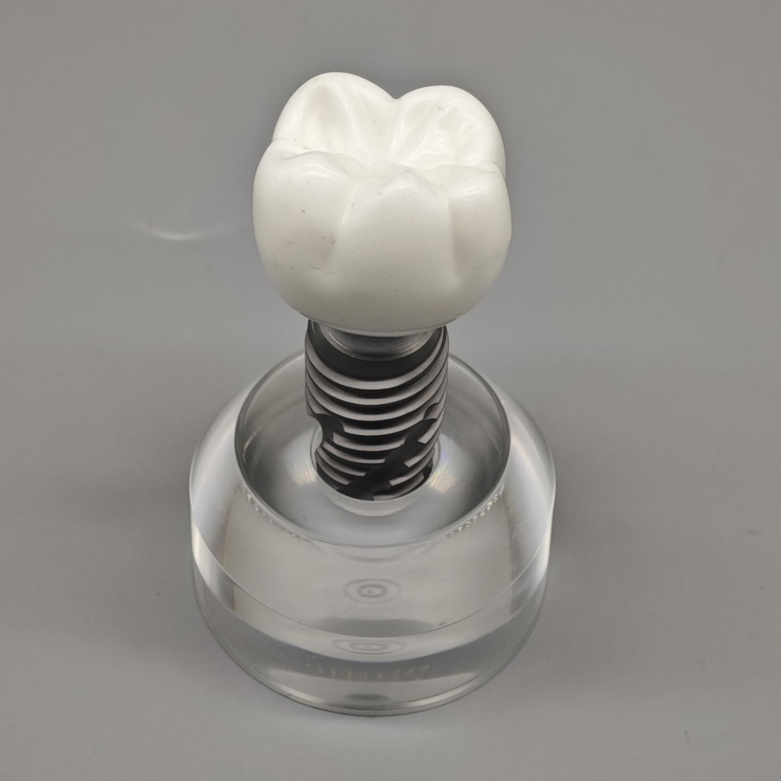 Modello di impianto in Cristallo Modello didattico Dentale e Orale Denti Trasparenti per Studio e insegnamento