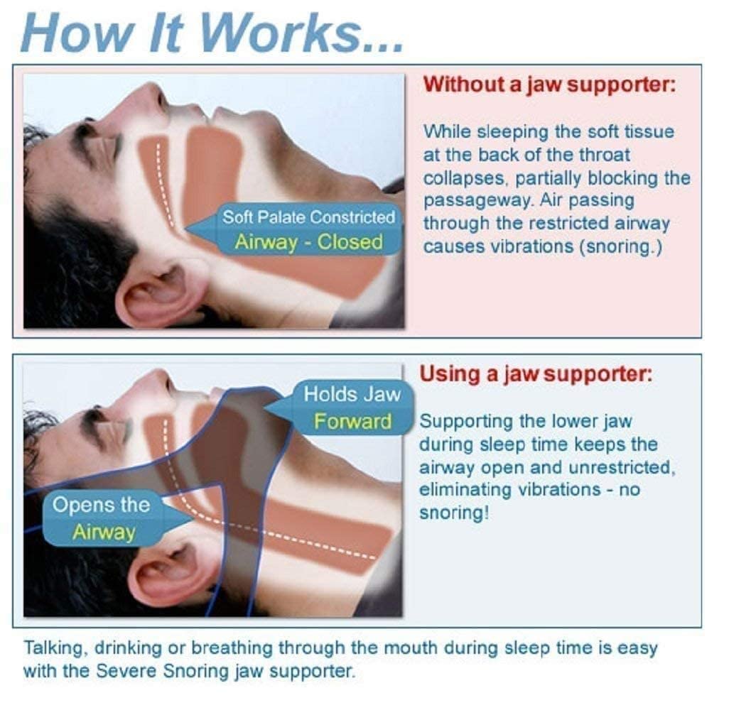 Gnanex Anti-Snoring Chin Adjustable Snore Reduction Belt, Stop Snoring Anti-Snoring Belt for Men Women Reduces Snoring Solution (Fits All Size Heads) 4