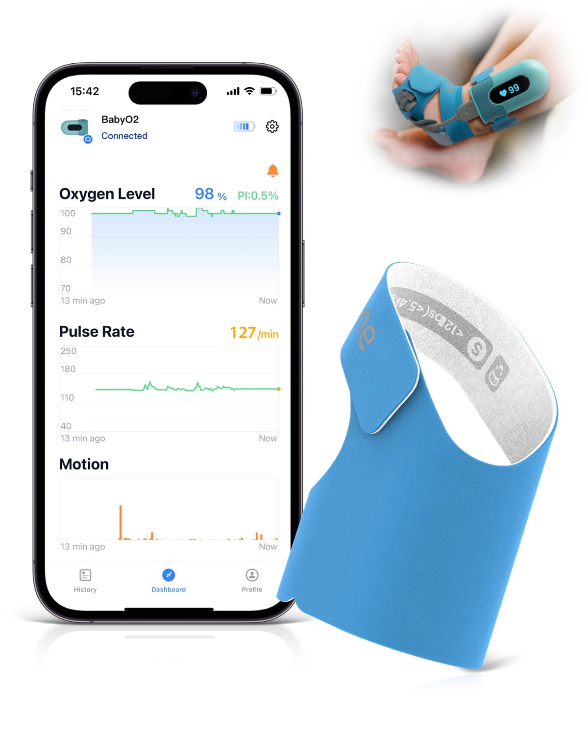 Baby Sock pulsioxímetro pie de bebé, realiza un Seguimiento Continuo del Nivel de oxígeno, la frecuencia cardíaca y los Movimientos corporales de su bebé