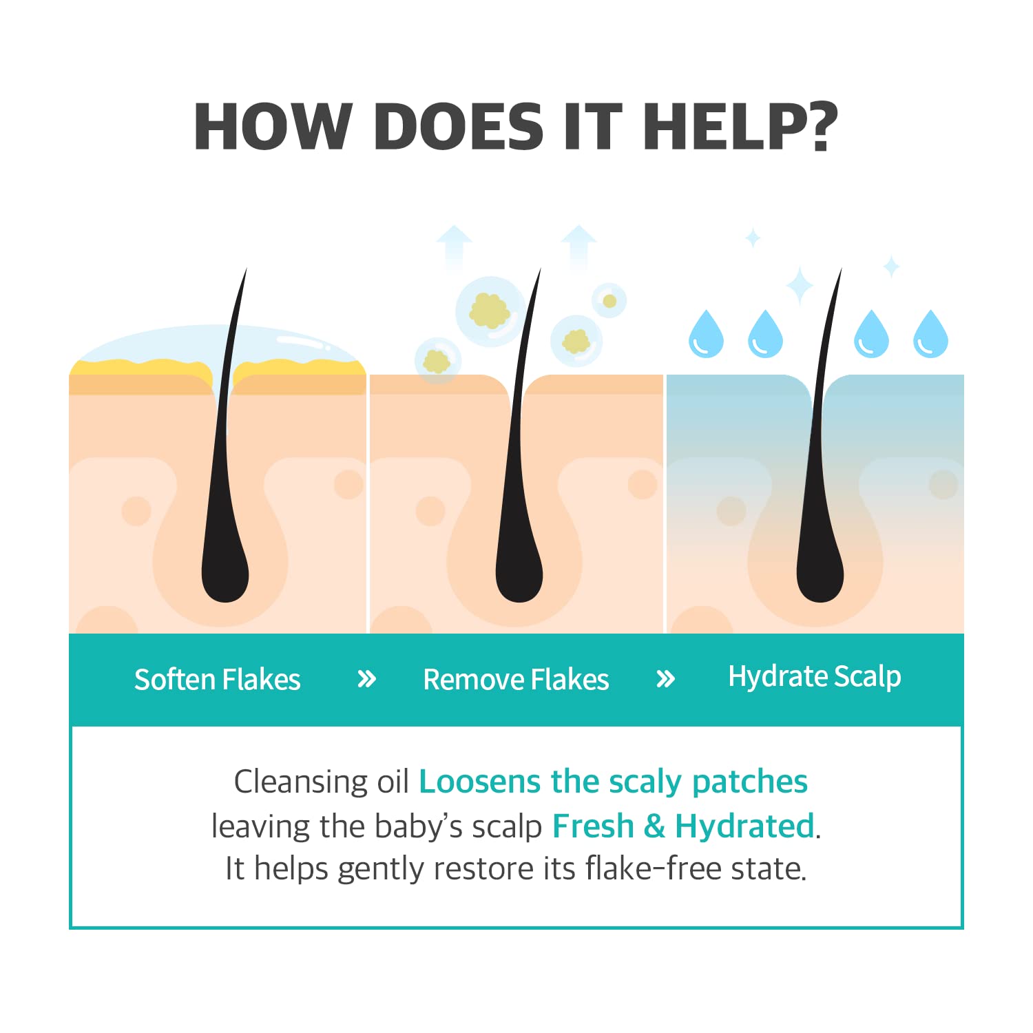 kori in J island Baby Scalp Cleansing│Baby Bath Essentials│Scalp Brush│koriinj Clear White
