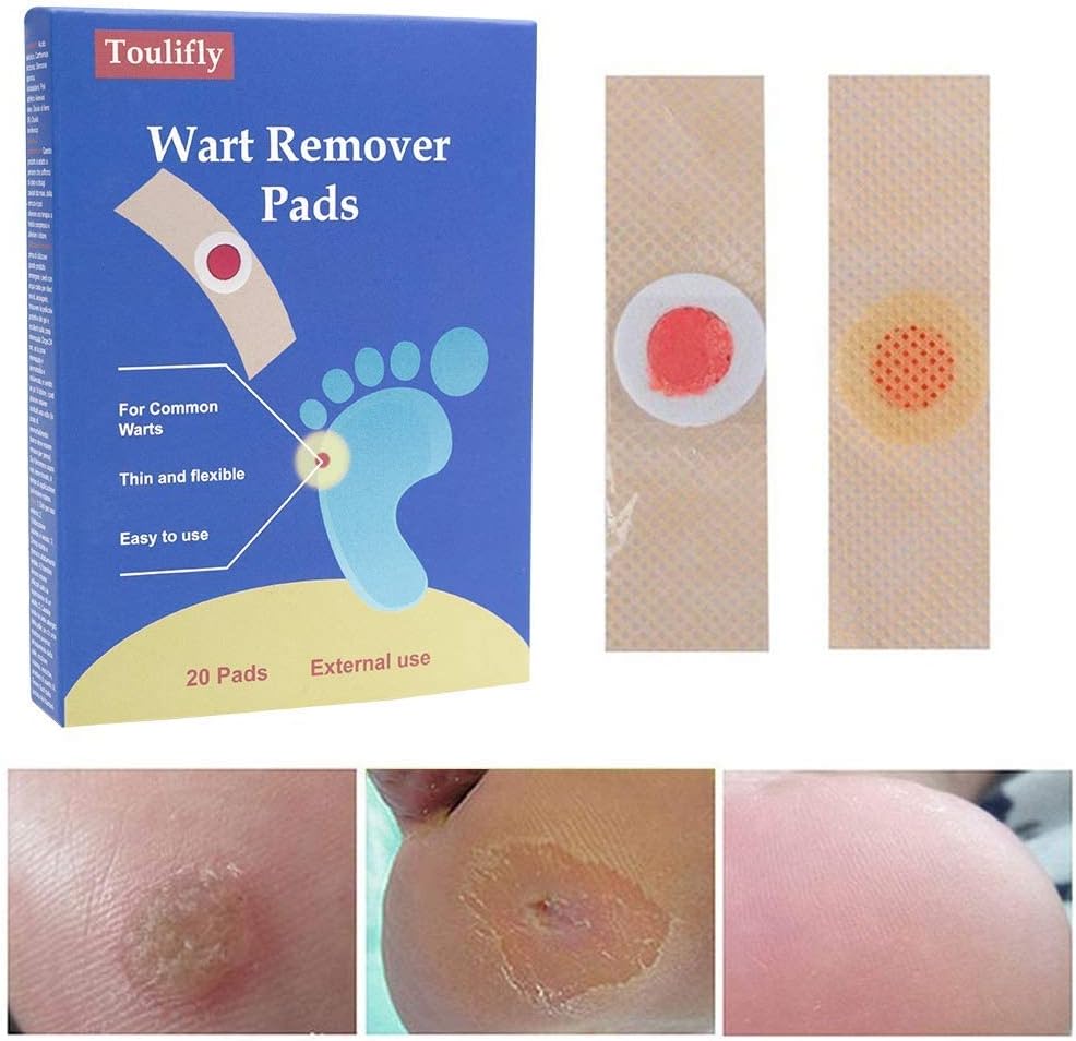 Wart Remover, Wart Removal Treatment, Corn Remover, Foot Corn Remover Pads, Plantar Wart Removal, Penetrates and Removes Common and Plantar Warts, Callus, Stops Wart Regrowth