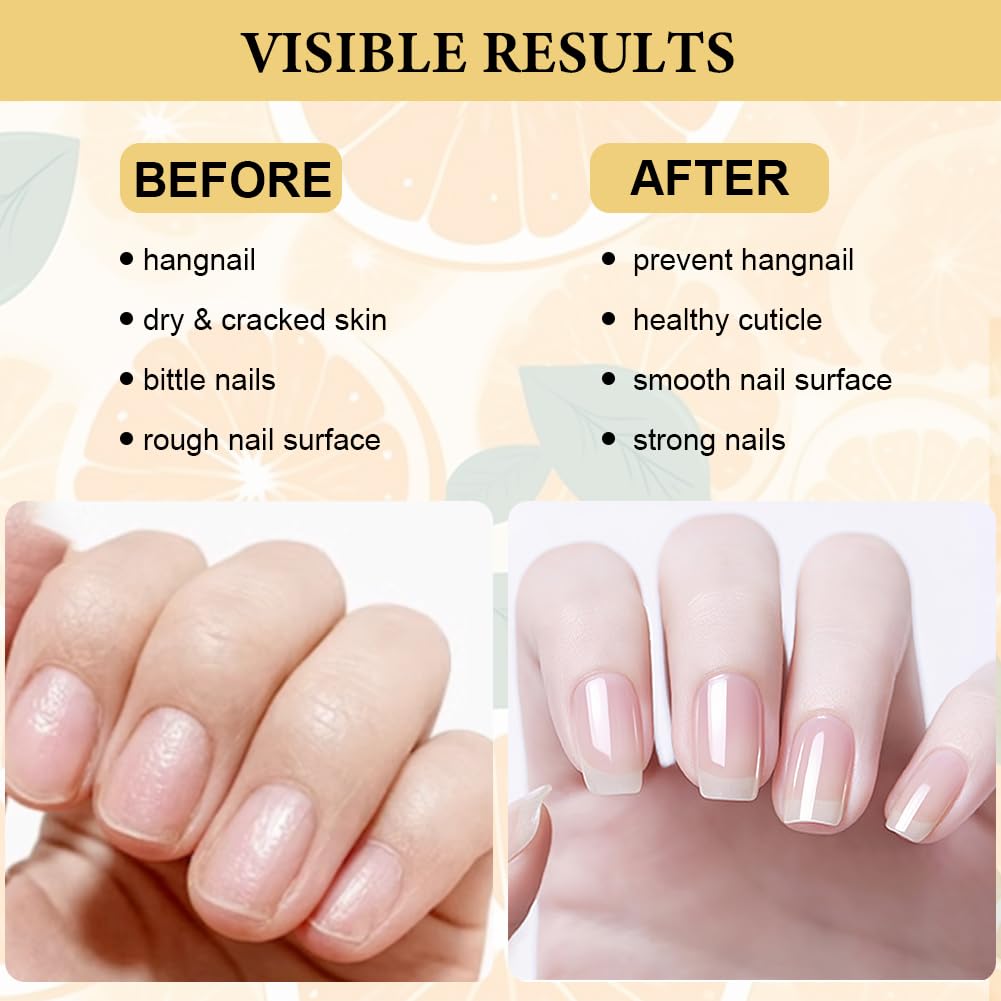 LOPHE Hydrating Cuticle Oil, 2pcs Cuticle Oil for Nails Nail and Cuticles Oils Contain Vitamin B, Moisturizes Cuticles - Image 3