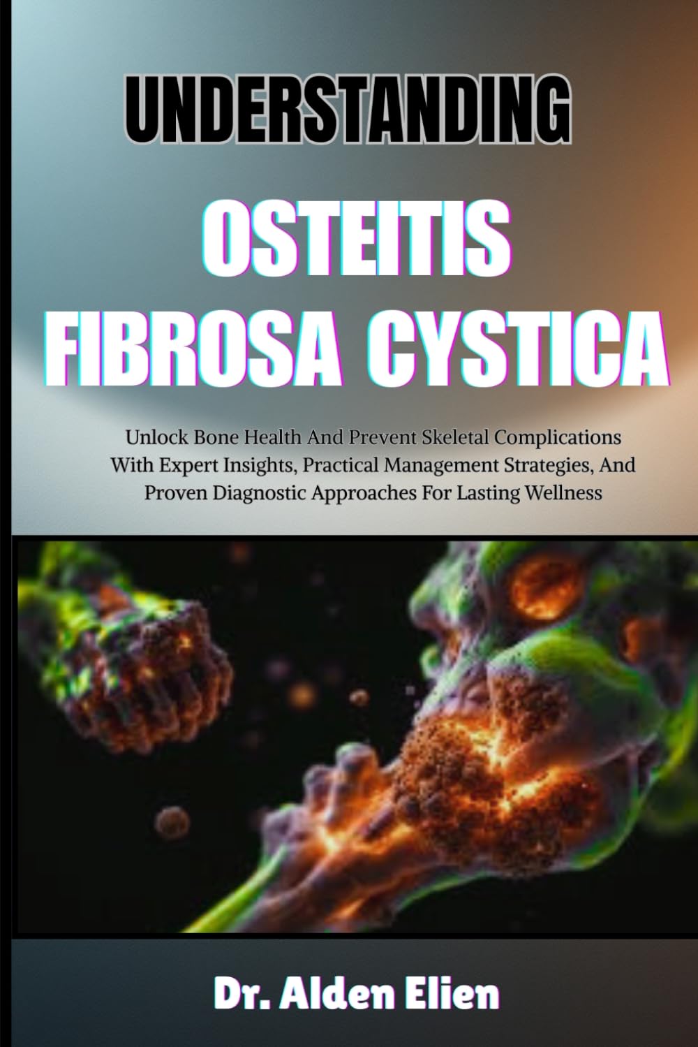 UNDERSTANDING OSTEITIS FIBROSA CYSTICA: Unlock Bone Health And Prevent Skeletal Complications With Expert Insights, Practical Management Strategies, ... Diagnostic Approaches For Lasting Wellness