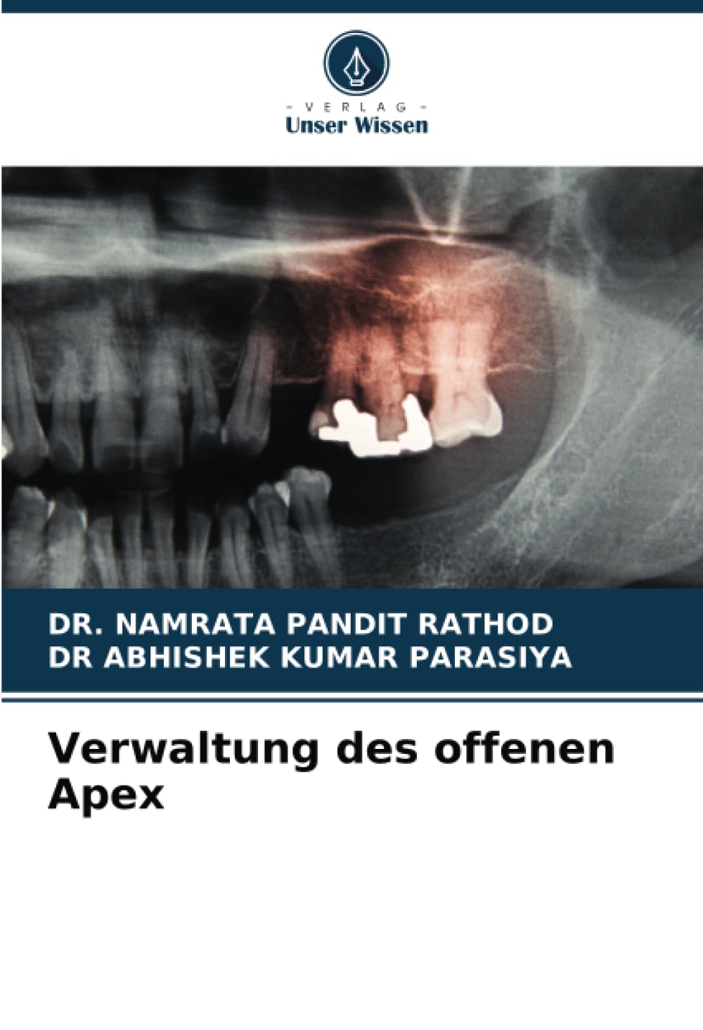 Verwaltung des offenen Apex