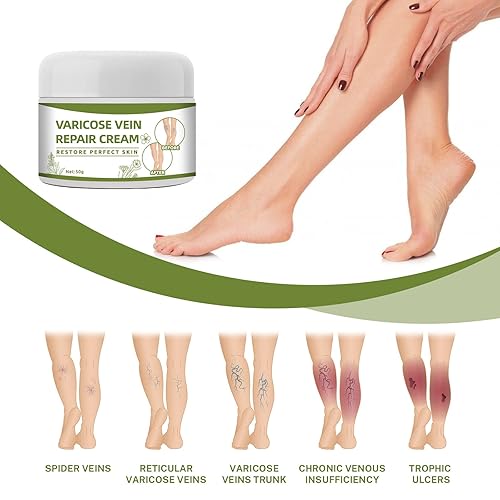 Miniatura 3 de Crema de venas varicosas crema reparadora de venas arañas mejora la circulación sanguínea crema de tratamiento de venas varicosas para piernas dolor