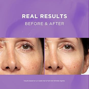 Fade Out Anti-Wrinkle Brightening Day Cream-Hyaluronic Acid