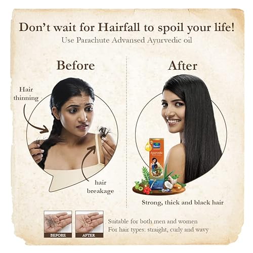 Parachute Advansed Ayurvedic Coconut Hair Oil With Basil (Tulsi), Aloe Vera, Flax Seed, Gooseberry (Amla) 25 Ayurvedic Ingredients Controls Hair Fall, Dandruff, Hair Thinning All Hair Types 10.1 Floz #TOP5