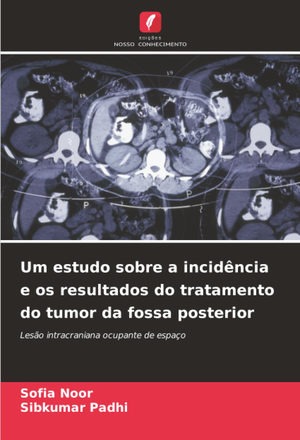 Um estudo sobre a incidência e os resultados do tratamento do tumor da fossa posterior: Lesão intracraniana ocupante de espaço