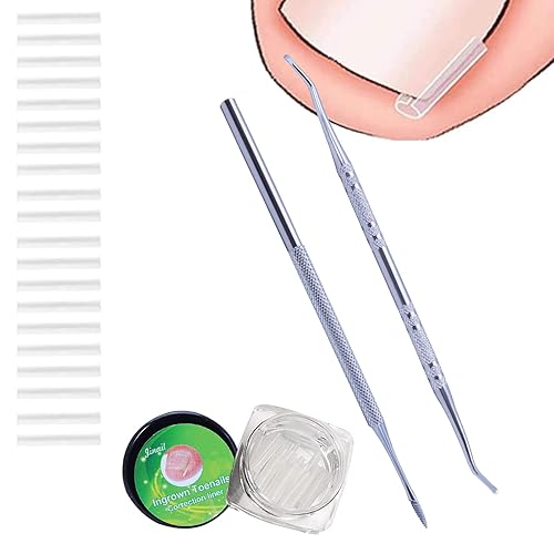 Paquete de 20 + 2 unidades, kit profesional de tratamiento de corrección de uñas encarnadas, 2 limas y levantador de uñas de los pies, 20 tiras