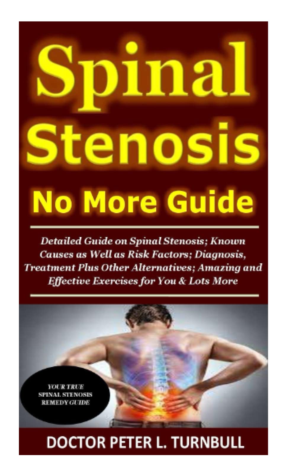 Spinal Stenosis No More Guide: Detailed Guide on Spinal Stenosis; Known Causes as Well as Risk Factors;Diagnosis,Treatment Plus Other Alternatives;Amazing and Effective Exercises for You & Lots More