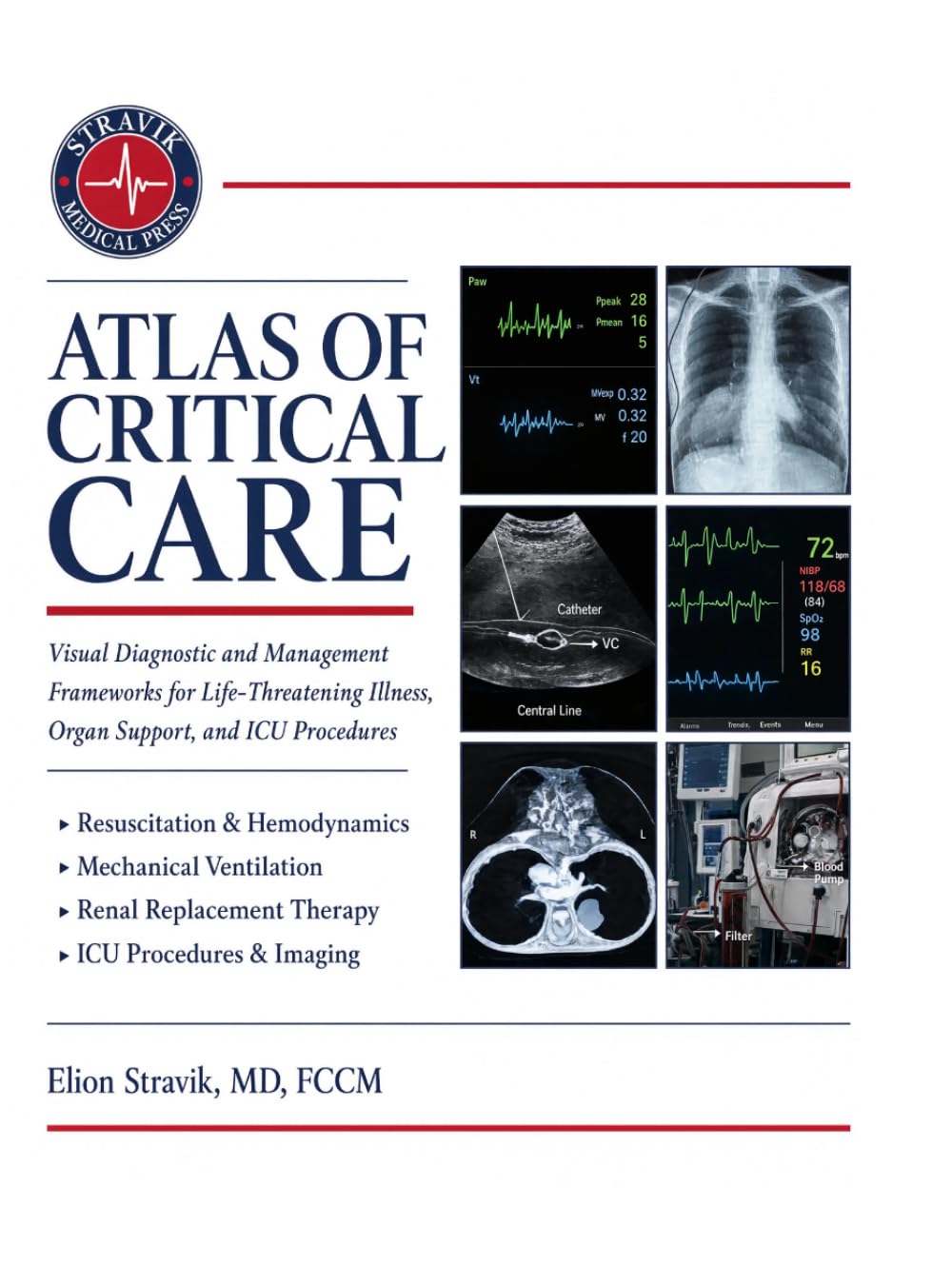 ATLAS OF CRITICAL CARE: Visual Diagnostic and Management Frameworks for Life-Threatening Illness, Organ Support, and ICU Procedures