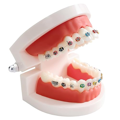 Miniatura 1 de Modelo de dientes de ortodoncia dental con aparatos ortopédicos coloridos, modelo profesional de boca de dentadura para demostración de estudio para