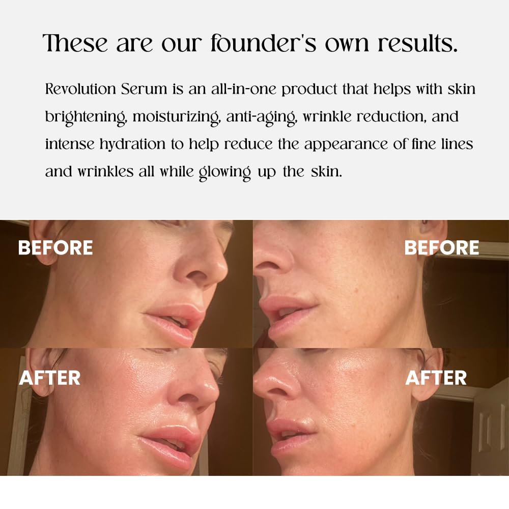 Clinical-grade vitamin C antioxidant serum with THD Ascorbate - boosts brightness, hydration, and collagen support without irritation.