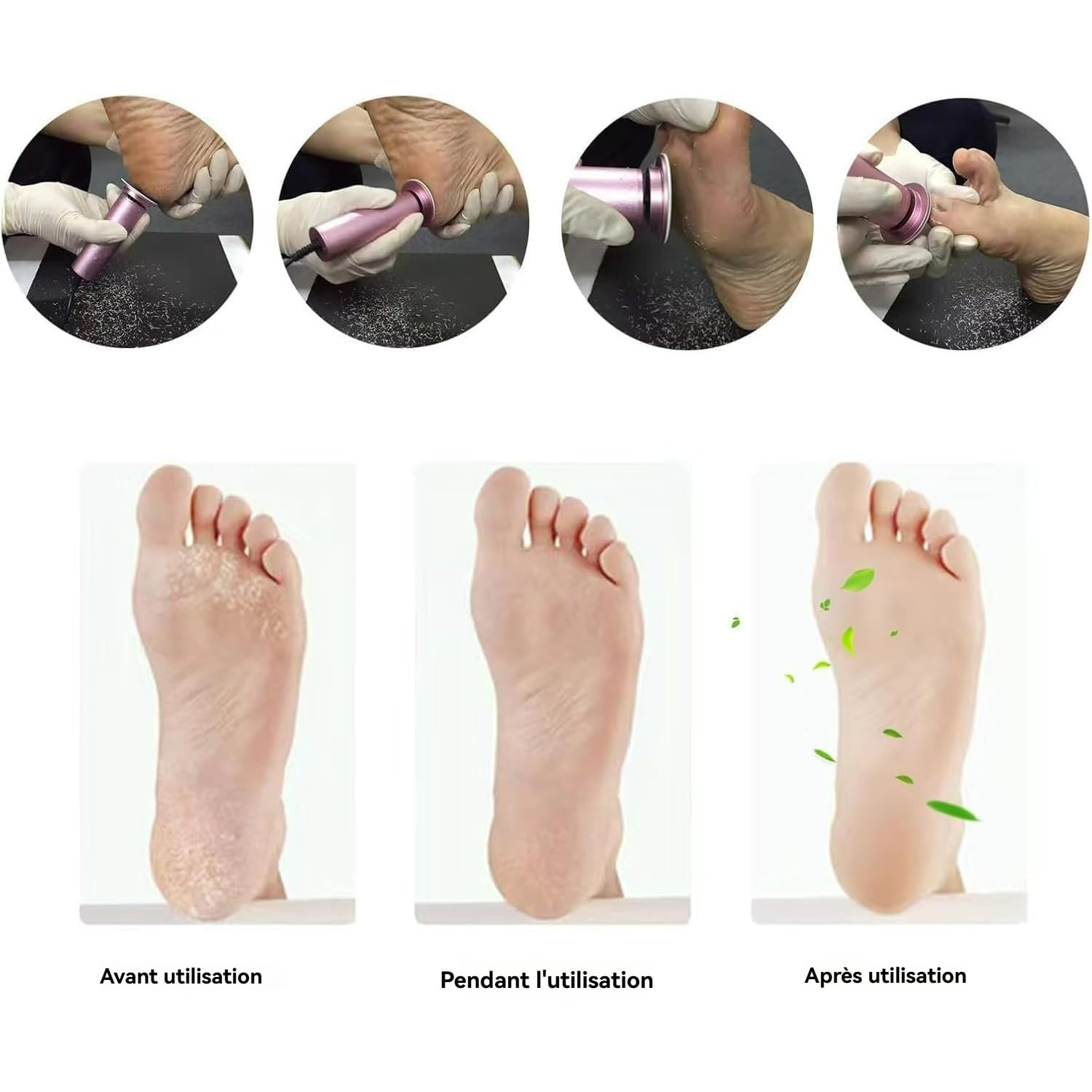 Mielle Glow Pied, Honey Glow Pied, Mielle Ponceuse sur Pied, Rapeuse Pieds Électrique Livré avec 60 Recharges de Tampons Exfoliants, pour Peaux Mortes, Squameuses et Craquelées (Or)