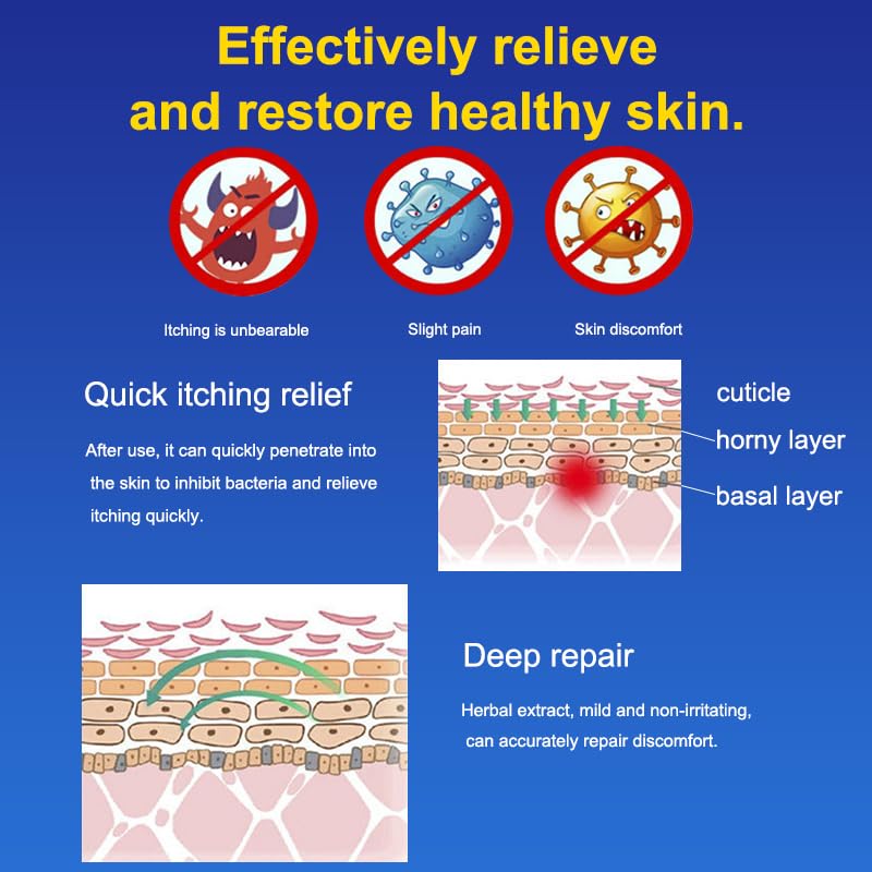 Eczema Care and Anti-itch Cream for Men and Women. Suitable for Dry and Eczema-prone Skin. Suitable for Itchy Skin, Wet Itching, Urticaria, Dermatitis. Unscented and Preservative-free. 20g - Image 4