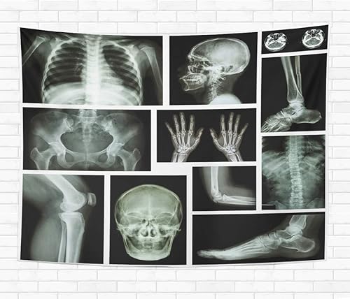 Topyee Tapiz decorativo para el hogar, para colgar en la pared, Anatomía de rayos X, sistema esquelético humano de múltiples partes, 50 x 60