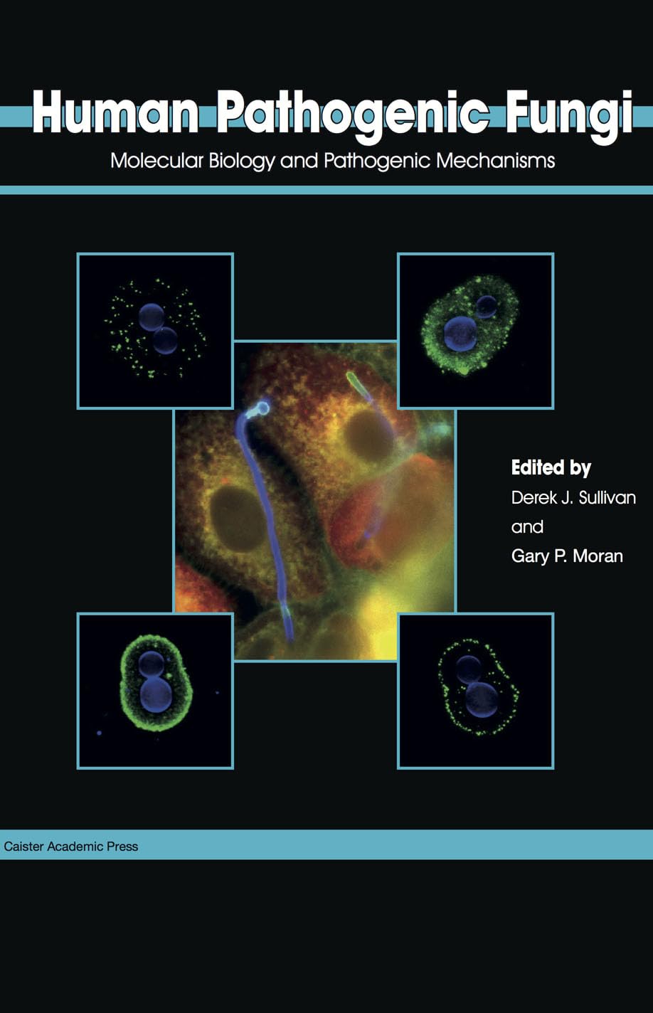 Buy Human Pathogenic Fungi: Molecular Biology and Pathogenic Mechanisms — BookShops.in