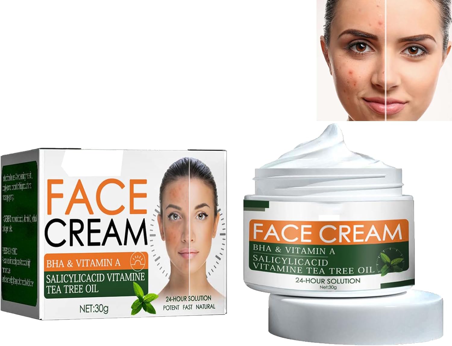 Acne Cream,Acne Scar Removal cream,Spot cream for Acne,Acne Cream