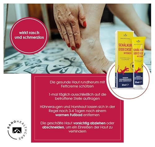 Eidechse Schälkur intensiv | Salbe gegen Schrunden, Schwielen, Hühneraugen und Hornhaut | enthält 40% Salicylsäure | Rösch und Handel