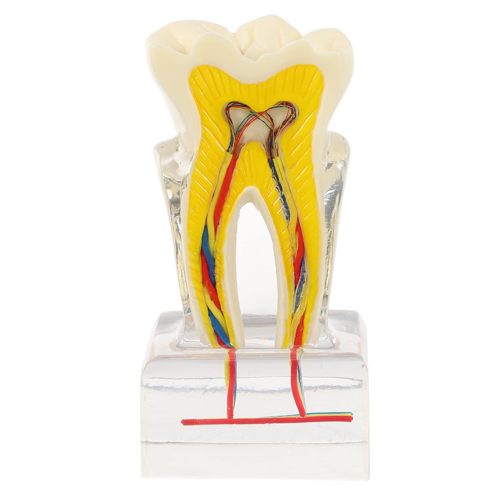 PRETYZOOM 6volte Modello Di Denti Dentali Modello Di Studio Per Per Lezioni Di Odontoiatria Dimostrazione Di Impianto e Protesi Fissa