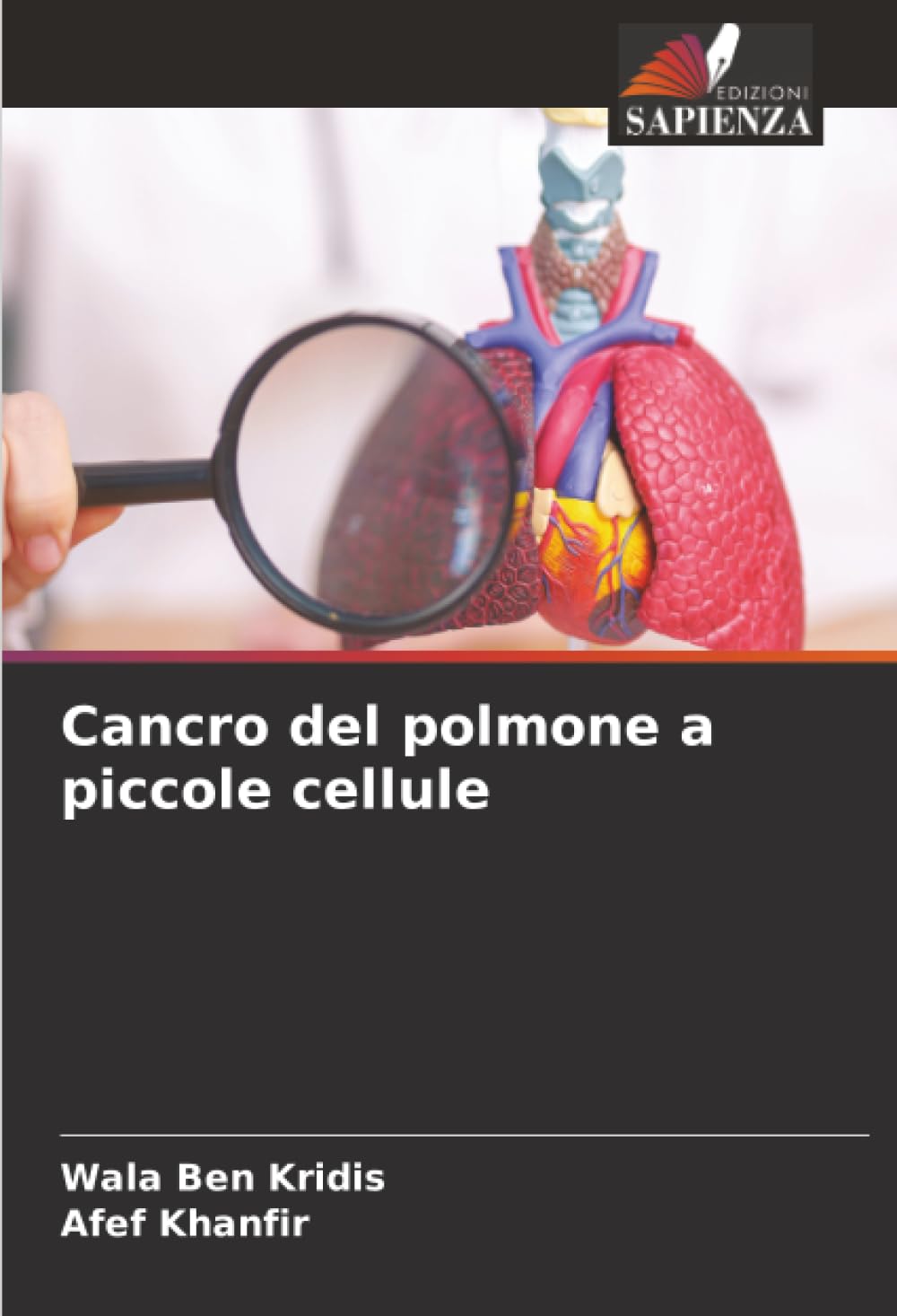Cancro del polmone a piccole cellule