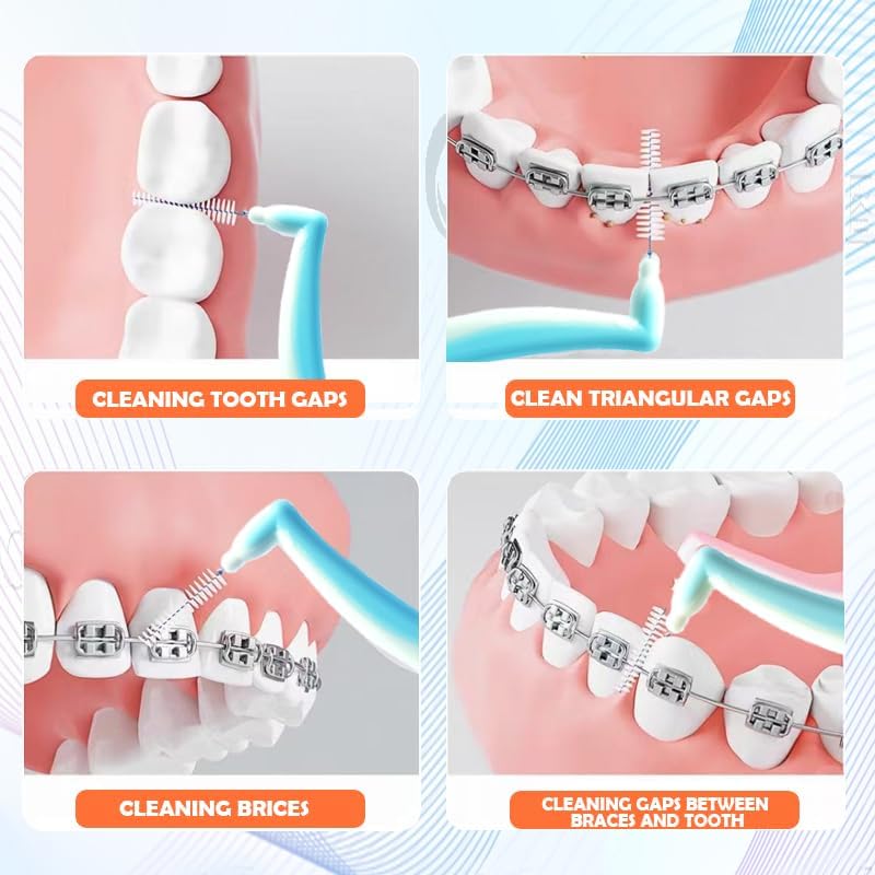 interdental Brushes, Angle Interdental Brushes, L- Shaped, Medium (0.6mm) for Normal & Medium Small Gaps, Pack of 10 pcs, Dental Brush for Cleaner Interdental Toothpick, Tooth Flossing,