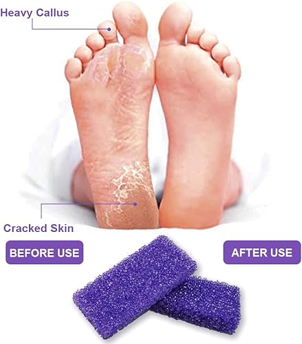 Miniatura 6 de Piedra pómez para pies, esponja para eliminar callos de piel muerta, suministros de pedicura, salón de uñas, uso en el hogar, 40 unidades