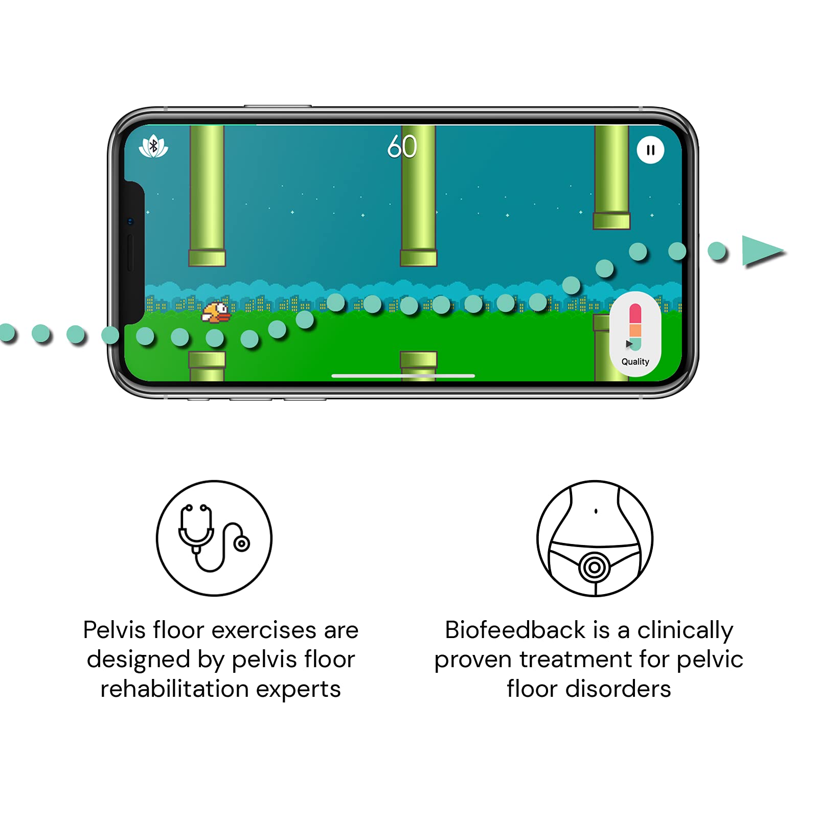 Perifit Kegel Exerciser with App Pelvic Floor Trai...B089YVW72F