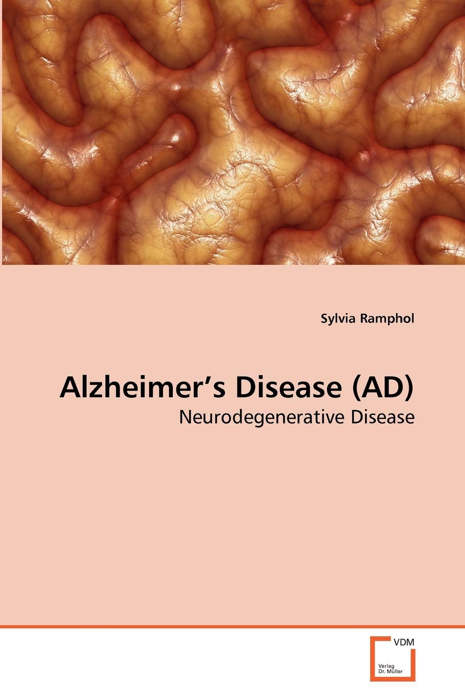 Alzheimer's Disease (AD): Neurodegenerative Disease