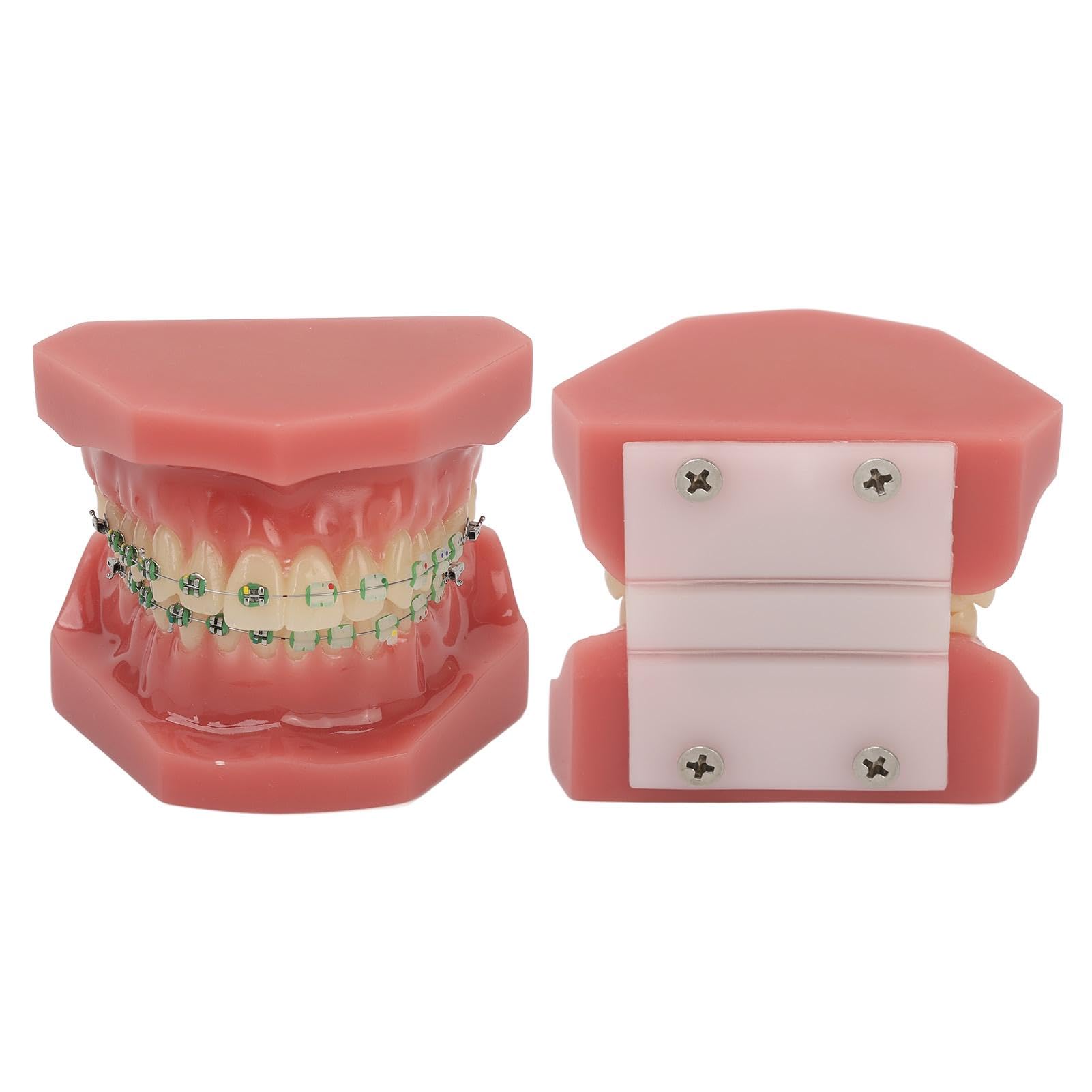 Modelo de Ortodoncia Profesional con Brackets Cerámicos y Metálicos para Enseñanza Odontológica