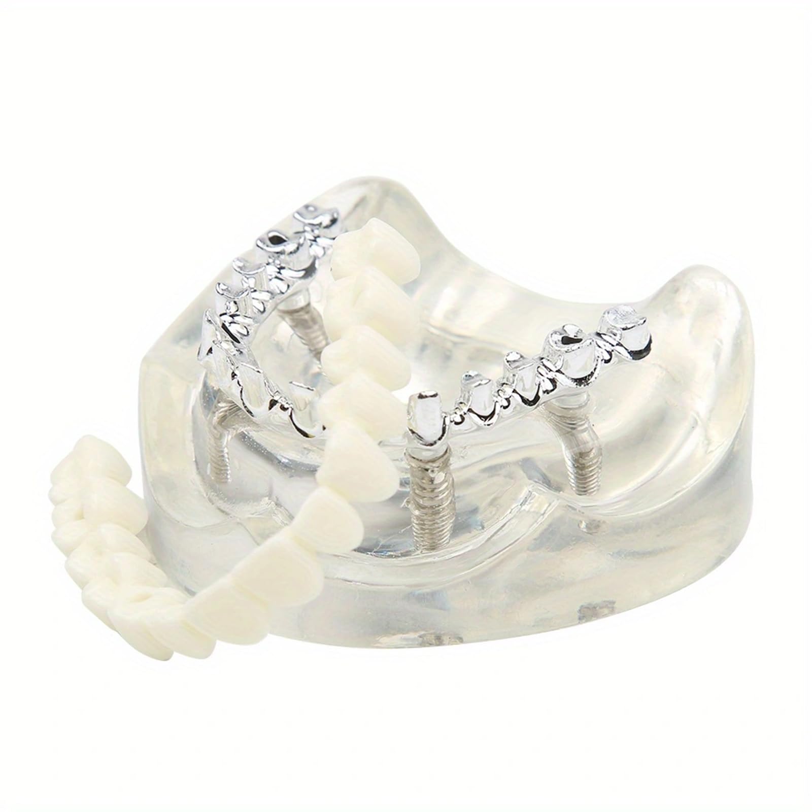 Transparent Dental Lower Jaw Implants Model Detachable Denture Model Dental Teaching Model Suitable for Education and Study