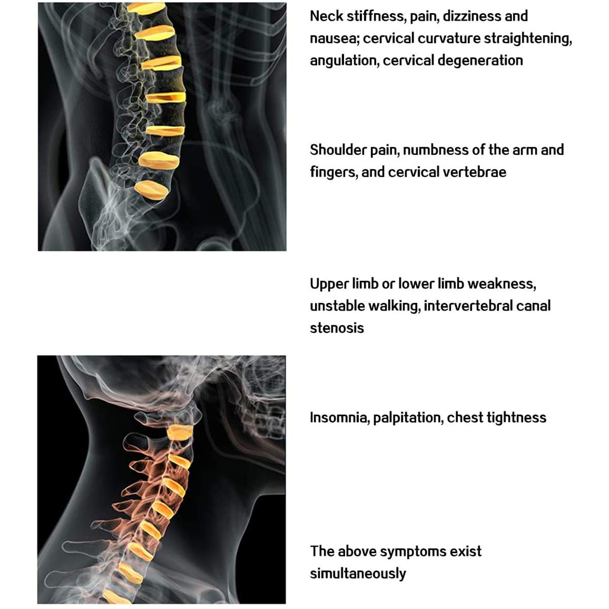 Dispositivo di trazione cervicale del Collare del Collare del Collo, Strumento di Fisioterapia, impacco Caldo, Collo Gonfiabile, Tratto di Cura Fisso