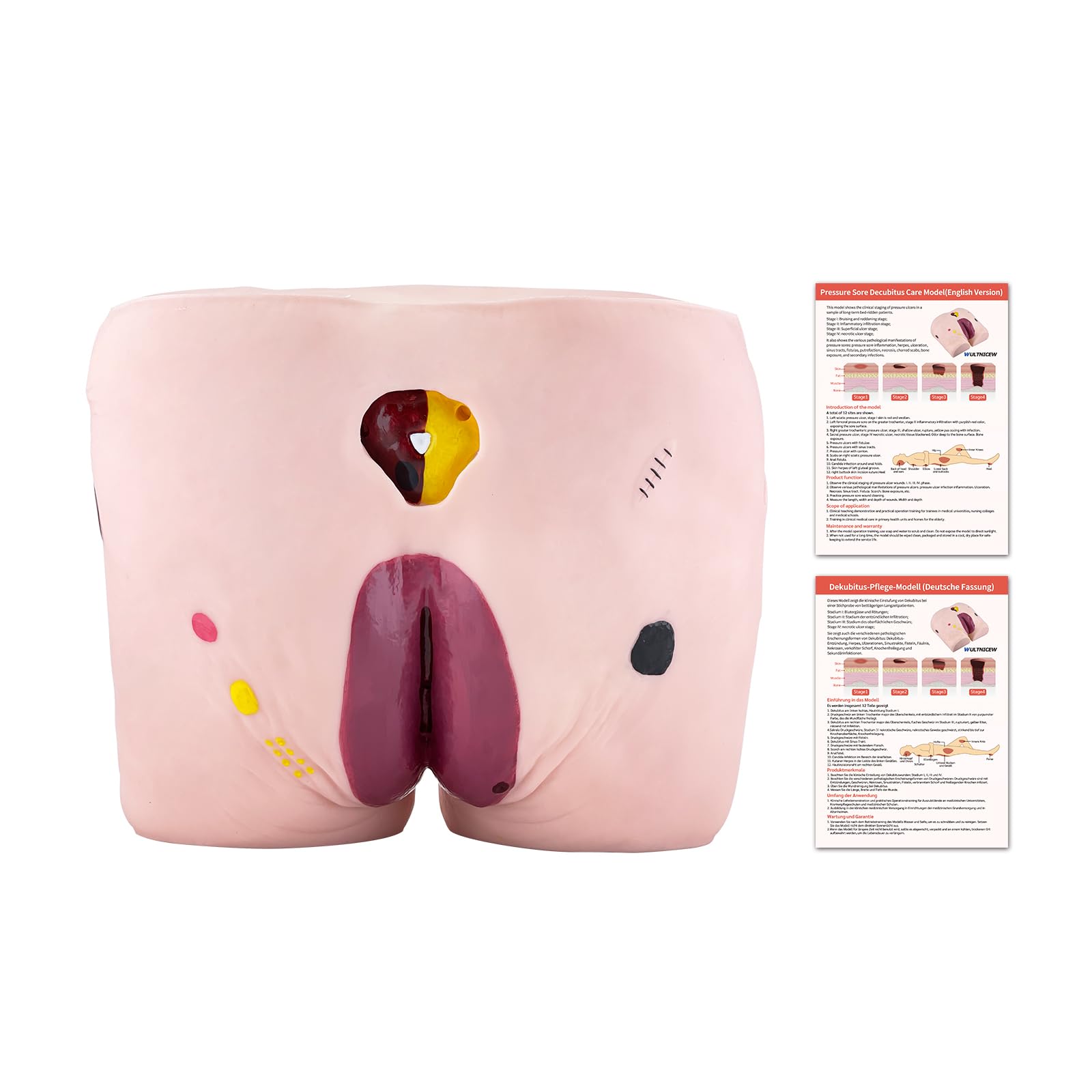 Modèle d'Ulcère de Décubitus Gériatrique, 4 Étapes Modèle d'Ulcère de Pression Avancé Kit de Modèle de Plaie avec Carte de Manuel de Produit pour l'Étude de l'Éducation Médicale