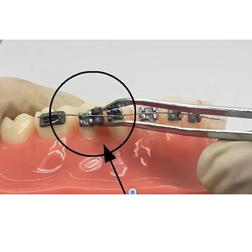 Miniatura 4 de 200pcs cuñas de rotación de ortodoncia bandas elásticas de goma ligadura rotativa almohadilla de torsión gris