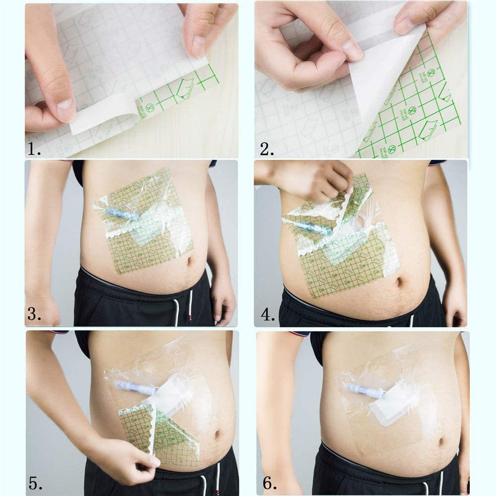 Wasserdichte Folienbadetasche Peritonealer Duschschutz Katheter-Wasserbarriere Peritonealdialyse