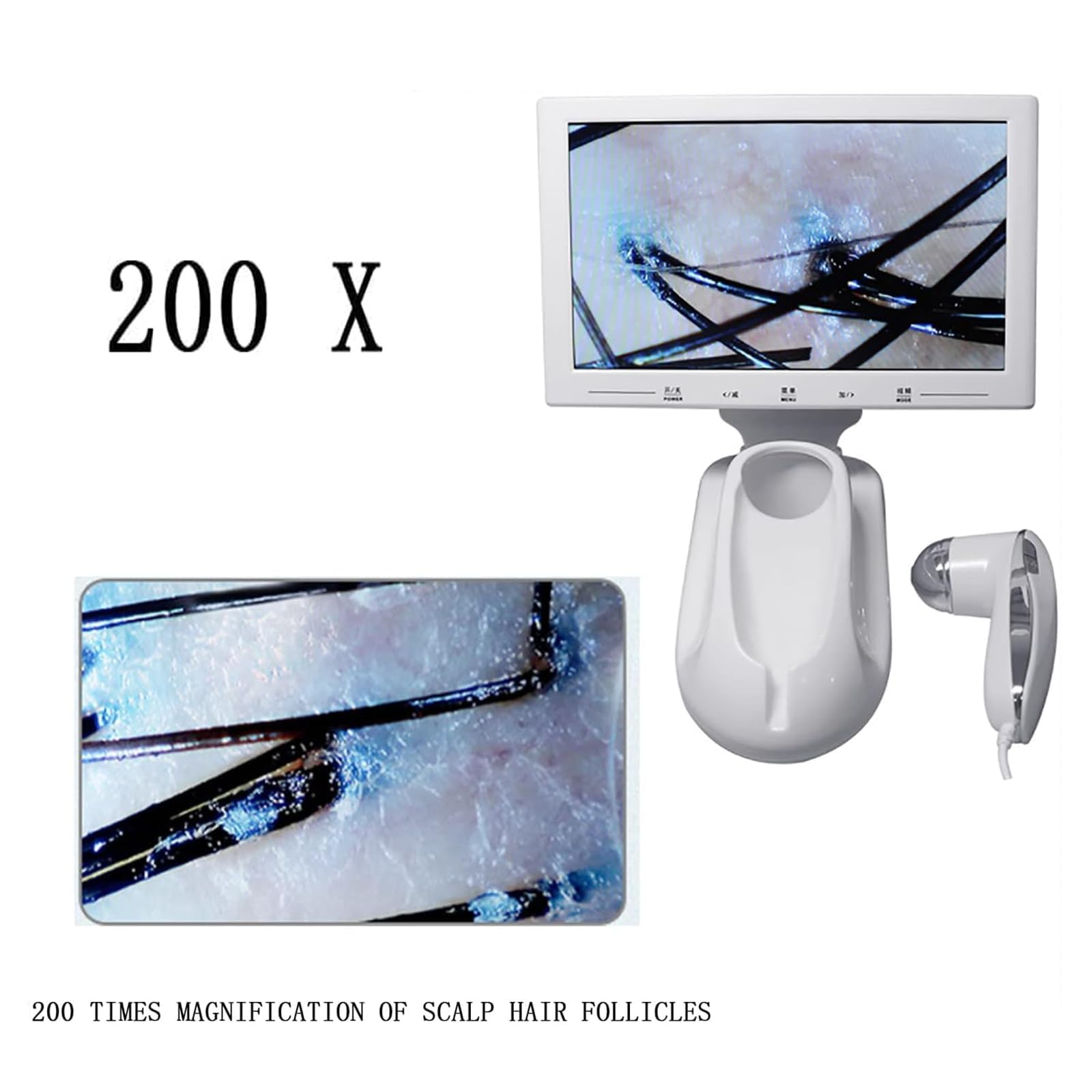 Haarfollikel-Analysegerät, Hautdiagnosegerät, 11-Zoll-HD-Display/200-fache Kopfhautlinse/Kann Fotos Aufnehmen Und Bilder Einfrieren, Um Verstopfte Poren Der Kopfhaut Zu Lösen